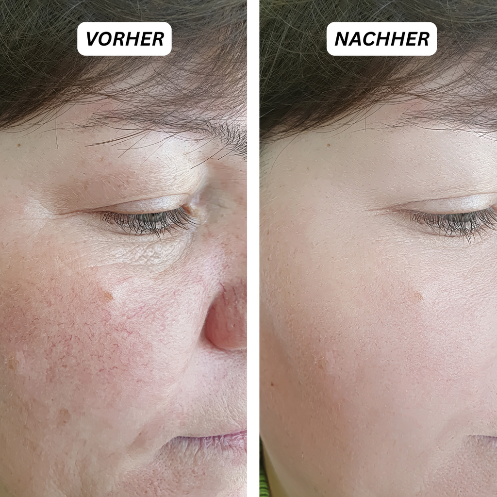 LUVÈLIA PhotonSkin™ 4D Glow Therapie-Maske