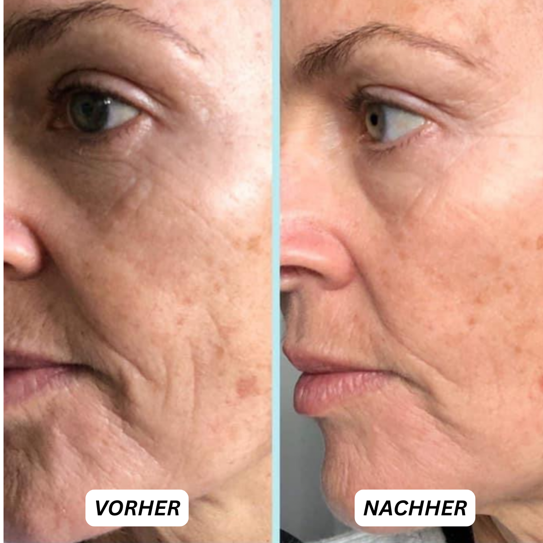 LUVÈLIA PhotonSkin™ 4D Glow Therapie-Maske